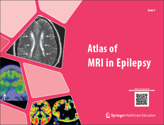 Atlas of MRI in Epilepsy - Issue 1