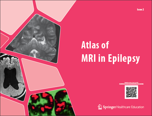 Atlas of MRI in Epilepsy - Issue 2