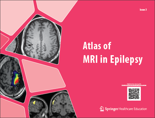 Atlas of MRI in Epilepsy - Issue 3