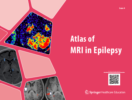 Atlas of MRI in Epilepsy - Issue 4