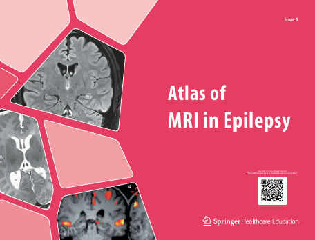 Atlas of MRI in Epilepsy - Issue 5